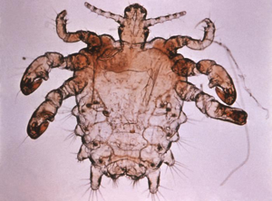 Pthirus pubis - crab louse.jpg © Kauczuk